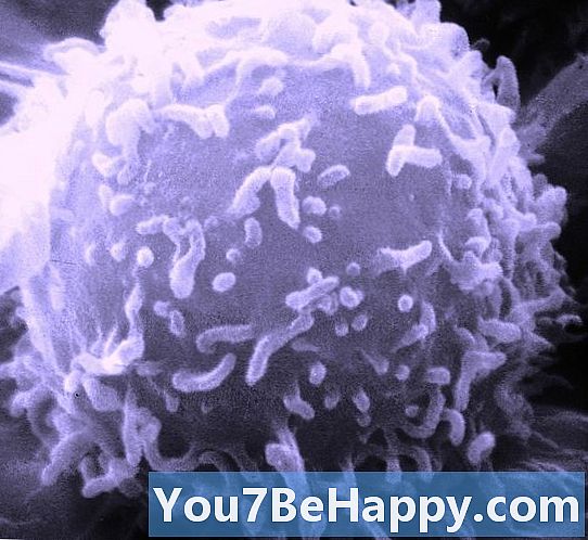 Леукоцити против лимфоцита - у чему је разлика?