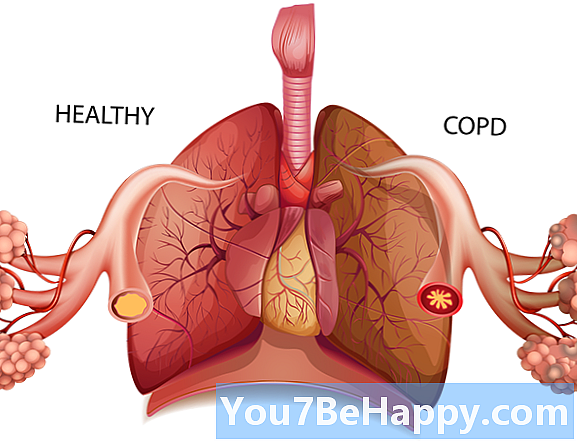 Lungen- und Atemwegserkrankungen - Was ist der Unterschied?