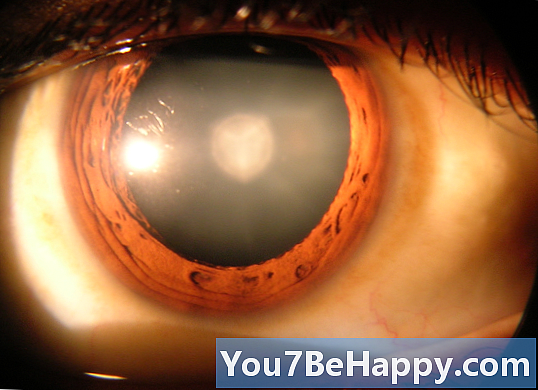 Cascadă vs. Cataractă - Care este diferența?