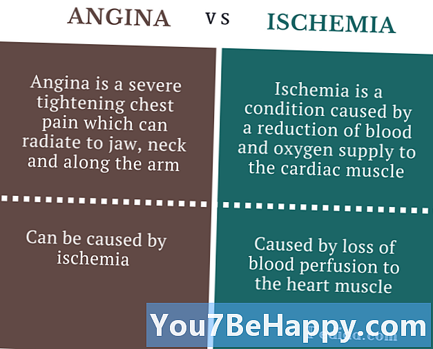 Разлика между ангина и исхемия