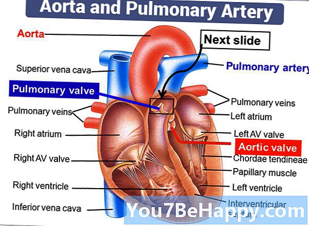 Diferencia entre aorta y arteria pulmonar