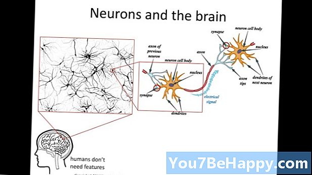 الفرق بين محور عصبي و dendrites