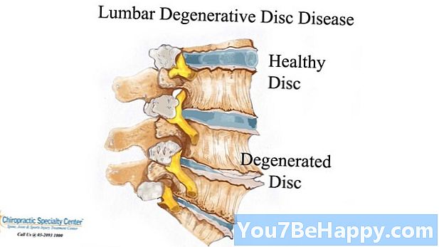 Rozdiel medzi bolesťou chrbta a obličkami