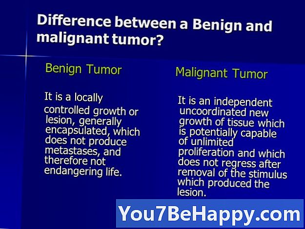Diferencia entre el tumor benigno y el tumor maligno