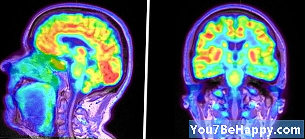 Perbezaan Antara Otak Kiri dan Otak Kanan