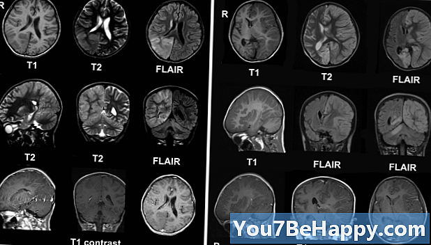 Forskjell mellom hjernehinnebetennelse og hjernebetennelse
